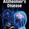 Brain Robber And New Treatments For Alzheimer's Disease