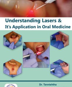 Understanding Lasers and it's Application in Oral Medicine